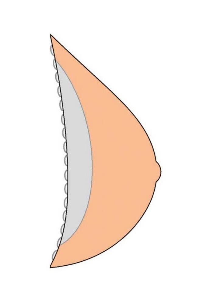 Breast Form X6522